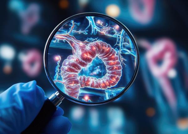 crestere ingrijoratoare a cancerului colorectal la persoanele sub 50 de ani