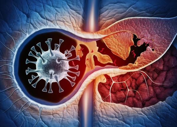 ficatul gras poate afecta si persoanele slabe dr liana gheorghe exista