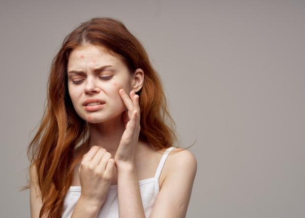 furuncul sau carbuncul cauze si simptome de ce apare si cum se trateaza corect