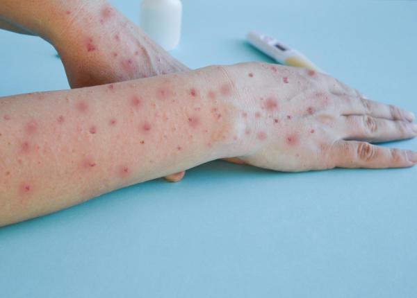 rata de vaccinare ror in romania sub pragul critic de 50 prof dr doina plesca inspaimantator