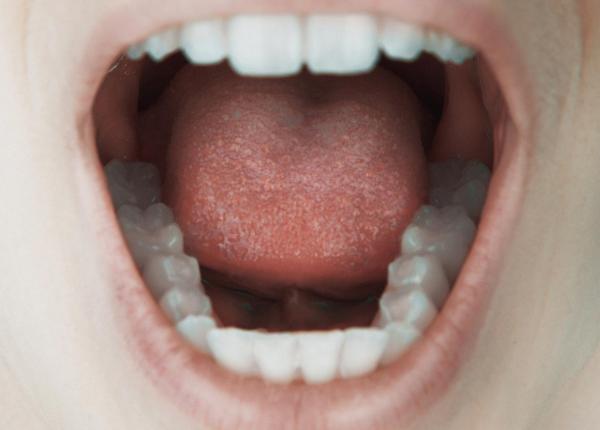 semnalele de alarma din gura care pot indica riscul de cancer de colon