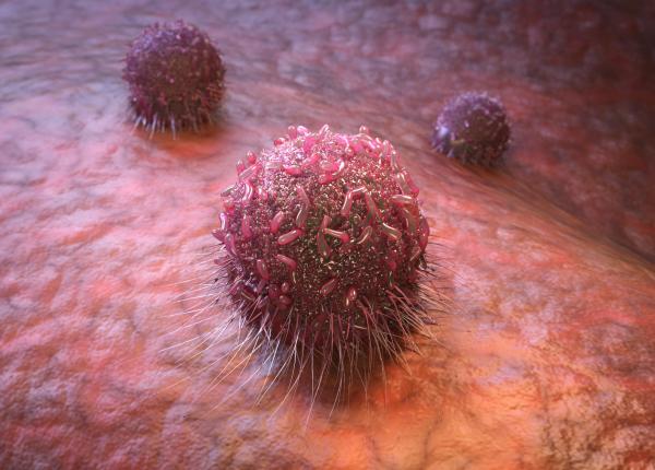 niste senzori subtiri cat un fir de par ar putea detecta cancerul