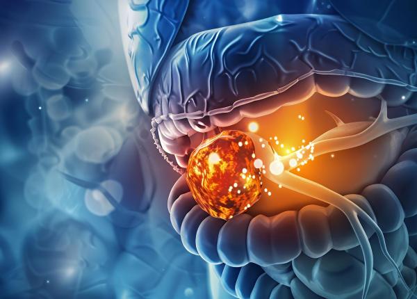 cum pot fi tratate tumorile fara bisturiu prof dr gabriel constantinescu minim invaziv