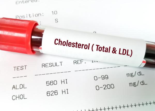 analiza de sange care prezice infarctul mai bine decat colesterolul marit