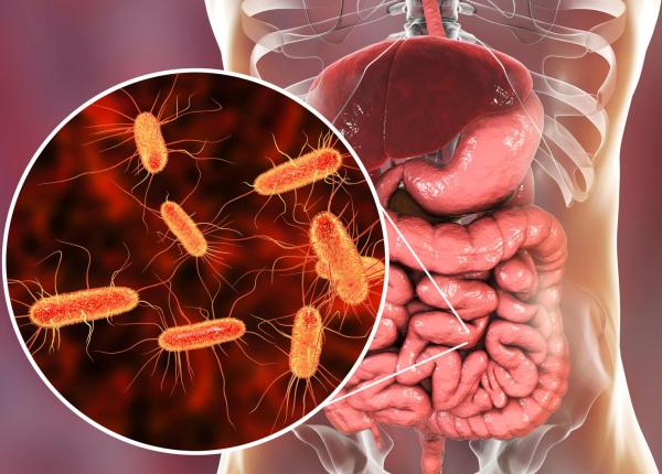 virusul care creste riscul de cancer colorectal