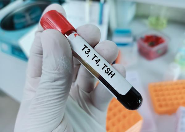 ce inseamna valorile tsh care este intervalul normal si ce simptome apar cand nivelul este prea mare sau prea mic