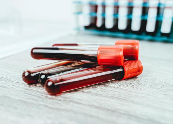 methylscan testul de sange ieftin care depisteaza cancerul inainte de aparitia simptomelor