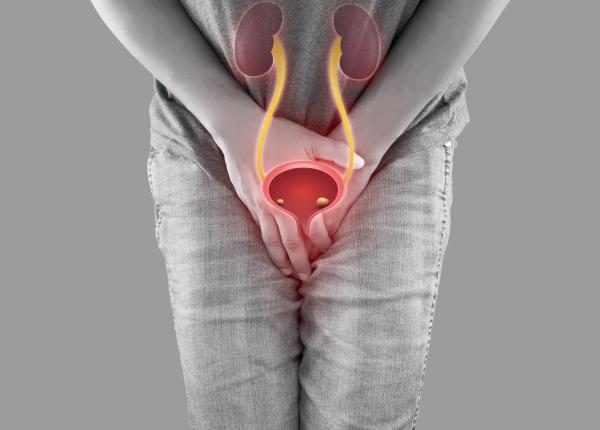 remedii care ajuta in vezica urinara hiperactiva asta reduce nevoia frecventa de a merge la toaleta
