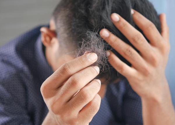 tratarea caderii parului la barbati cele mai eficiente doua medicamente aprobate pentru alopecie