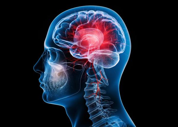 studiul care schimba tot ce stiam despre accidentul vascular cerebral