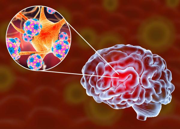 apel in sprijinul pacientilor cu neurofibromatoza de tip 1 diagnostic fara intarzieri tratament fara intreruperi