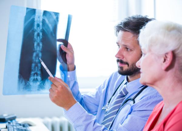 osteoporoza tratata mai eficient descoperirea care ar putea reduce riscul de fracturi