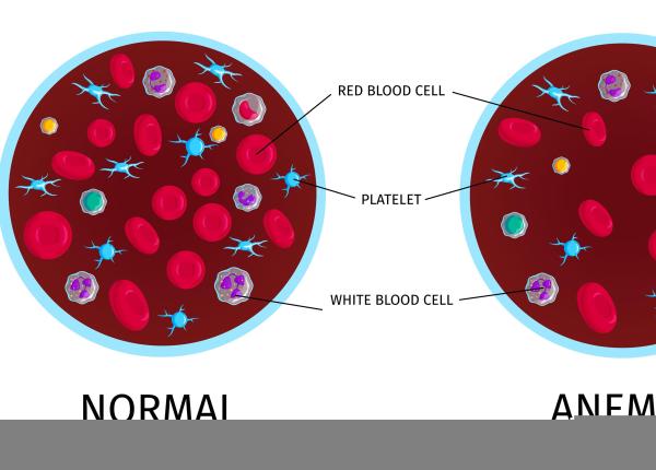 de ce apare anemia cercetatorii au identificat un hormon care franeaza formarea globulelor rosii