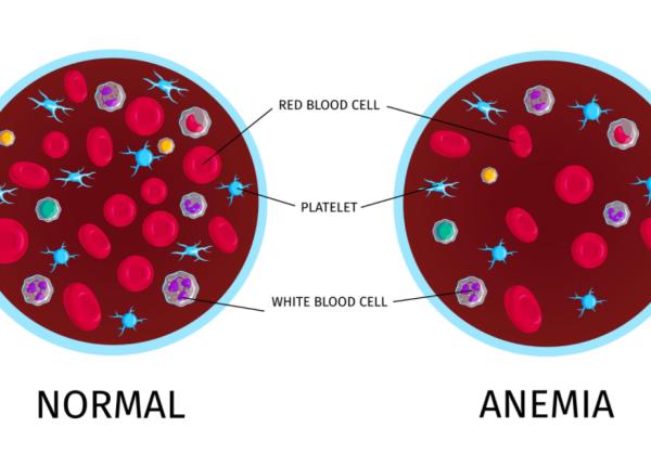 de ce apare anemia cercetatorii au identificat un hormon care franeaza formarea globulelor rosii