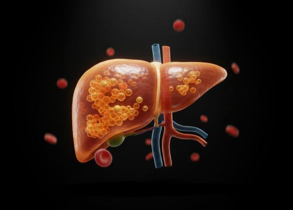 un obicei aparent banal care iti poate afecta ficatul pe termen lung un singur suc acidulat pe zi creste riscul de cancer hepatic
