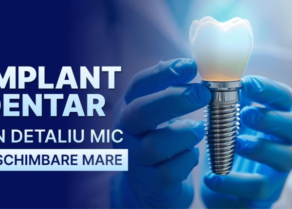 cat costa cu adevarat un implant dentar in bucuresti