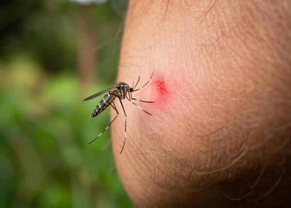 trucul simplu recomandat de un dermatolog pentru intepaturile de insecte