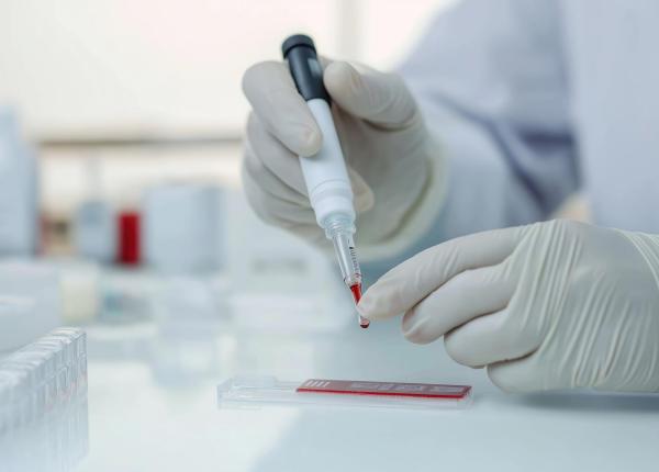 romania devine prima tara europeana in care pacientii vor putea avea acces la primul test de sange pentru evaluarea obiectiva a durerii si a riscului unor afectiuni de sanatate mintala