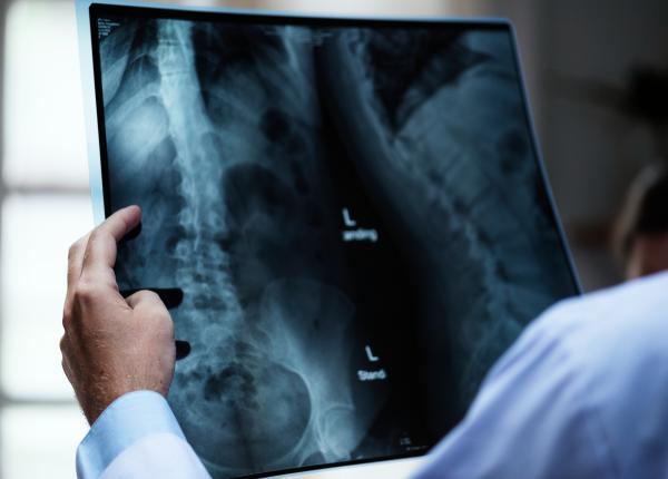 premiera istorica in medicina au fost facute primele radiografii in spatiu