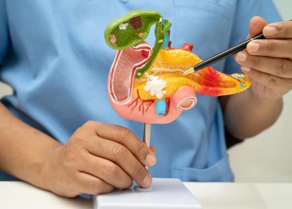 semnul discret care poate anunta cancerul cailor biliare dr ionut dudus sanador destul de tacut