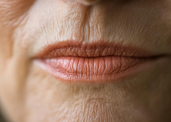 de ce isi pierd buzele culoarea odata cu varsta ce se schimba in organism si de ce apare acest fenomen