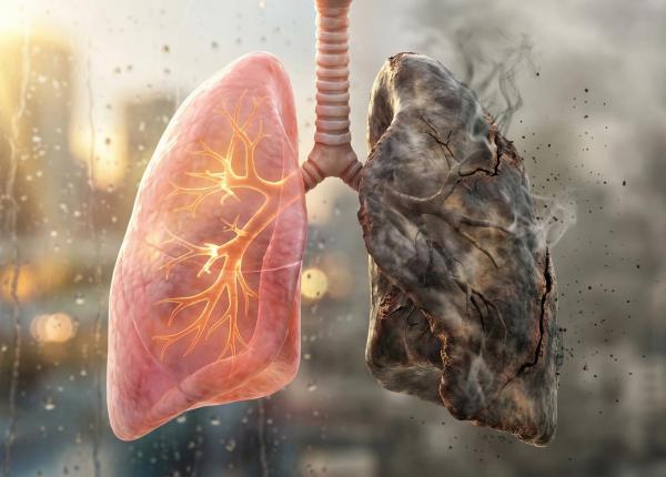 semnul banal al cancerului pulmonar cand trebuie sa mergi la medic
