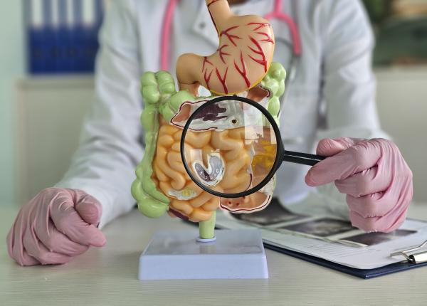 ce trebuie sa mananci dupa cancerul de colon dieta simpla care reduce riscul de deces cu 87