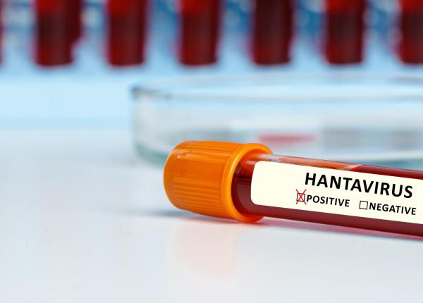 alerta in europa dupa un nou caz de hantavirus anzi singura tulpina care se transmite de la om la om