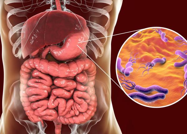 simptomele infectiei cu helicobacter pylori se poate trai cu aceasta bacterie in stomac