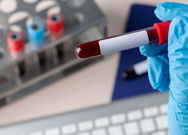 testul de sange care poate indica un risc mai mare de cancer cu ani inainte de diagnostic