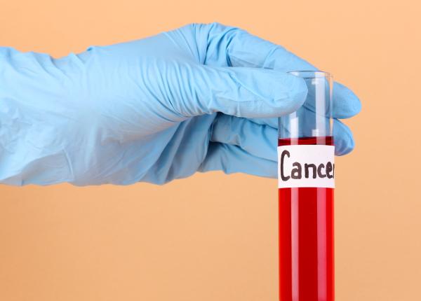 testul de sange care poate depista din timp recidiva cancerului