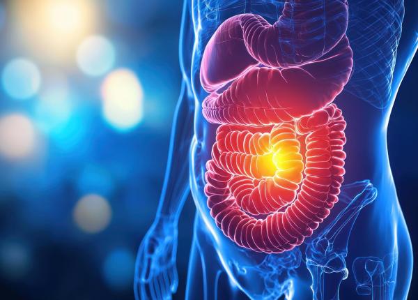 cancerul colorectal poate incepe fara simptome 7 semne pe care nu trebuie sa le ignori
