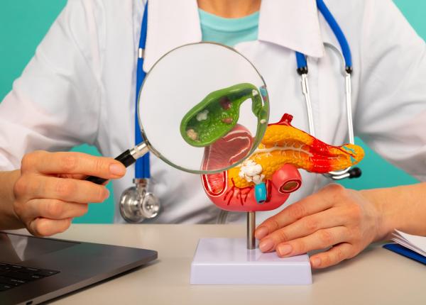care este legatura dintre cancerul pancreatic si colesterol