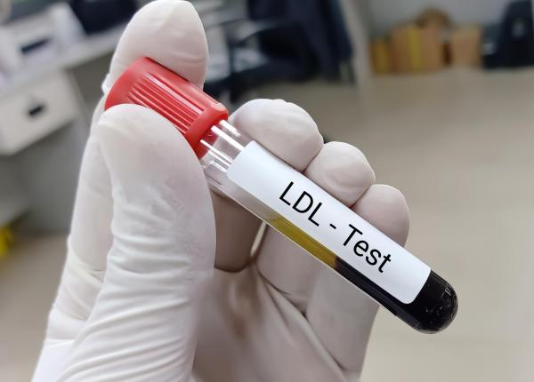 ce inseamna de fapt ldl scazut ce se intampla in corp cand colesterolul rau scade mult