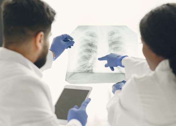 cancer pulmonar fara sa fi fumat vreodata de ce sunt din ce in ce mai multe cazuri