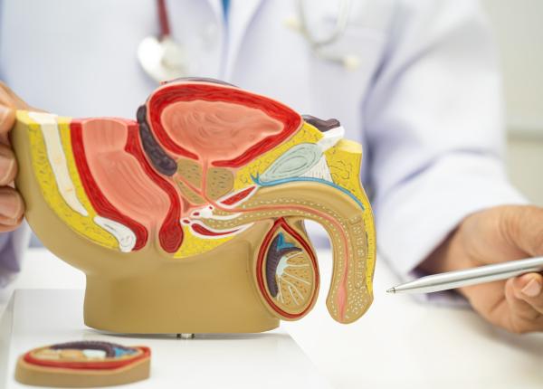 ce legatura exista intre cancerul de prostata si colesterol