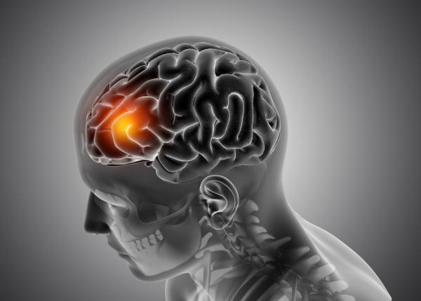 avc ul nu inseamna sfarsitul drumului ce se intampla in creier dupa un accident vascular cerebral