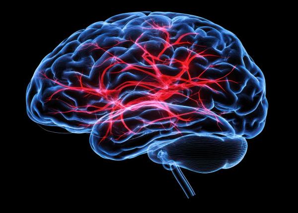 ce se intampla cu pacientul dupa un avc sever dr andra enache explica ce este neuropaliatia