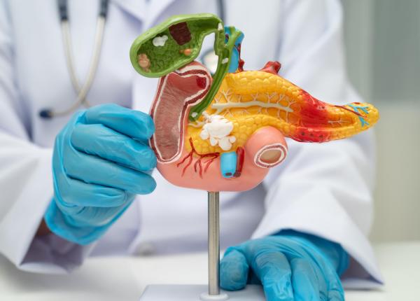 descoperire majora in cancerul pancreatic boala identificata inaintea simptomelor