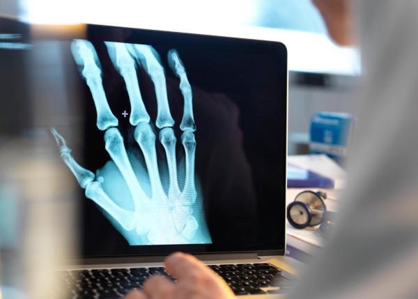 tratament experimental pentru osteoporoza testat pentru prima data pe oameni