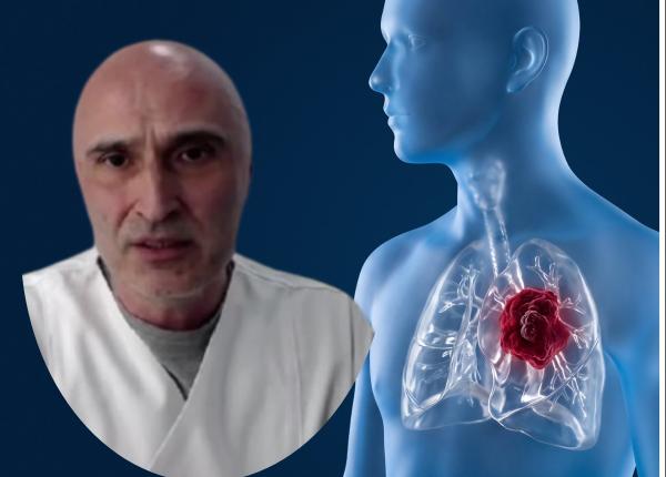 adenocarcinomul pulmonar poate aparea si la nefumatori prof univ dr cristian oancea explica ce sanse de supravietuire au pacientii
