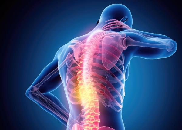 spondiloartrita axiala diagnosticul pus la timp ar putea proteja coloana vertebrala pe termen lung