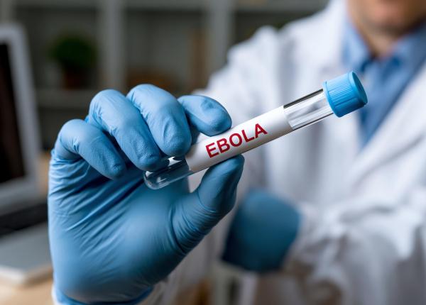 virusul ebola se extinde dr manuel albela miranda explica de ce este atat de greu de tinut sub control