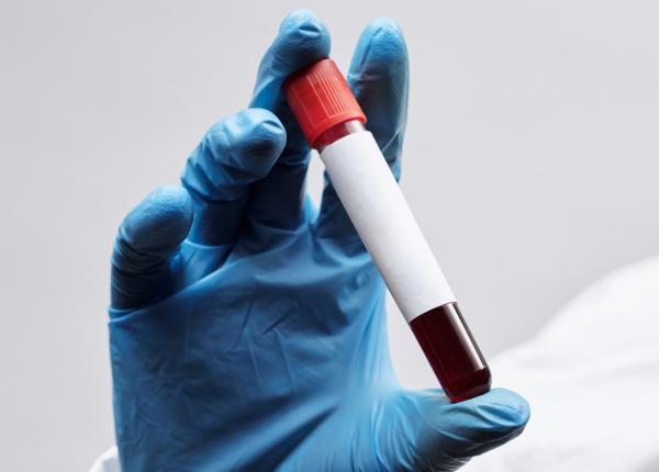 ast si alt crescute ce arata analizele ficatului si care e legatura cu cancerul