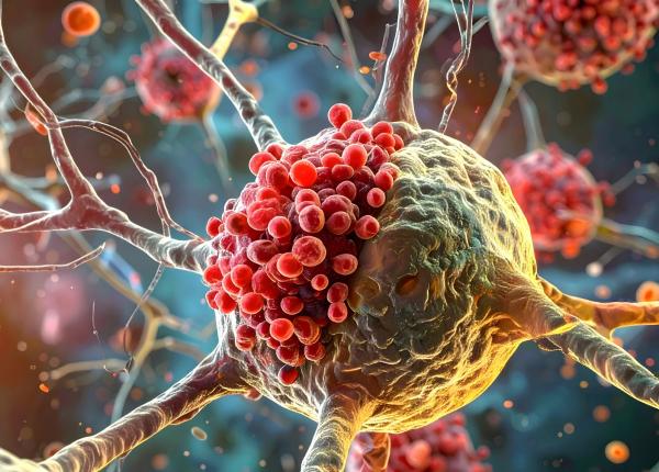 obiceiul care duce la cancer prof univ dr olga simionescu este factorul cancerigen