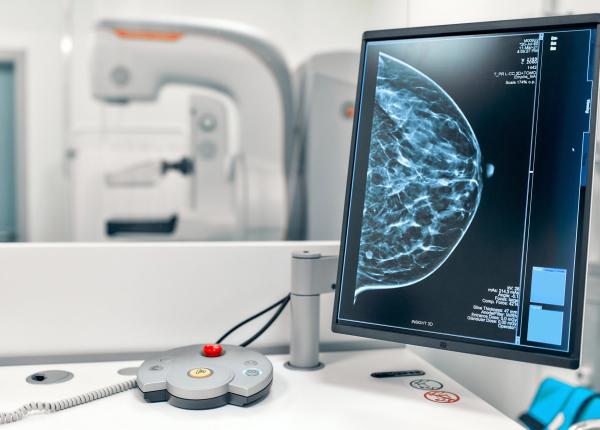testele de 2 minute care estimeaza riscul de cancer de san dr stefan voiculescu sanador boala poate aparea si fara antecedente familiale