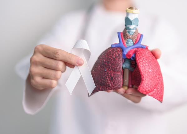 cancerul pulmonar agresiv ar putea fi monitorizat printr un simplu test de sange