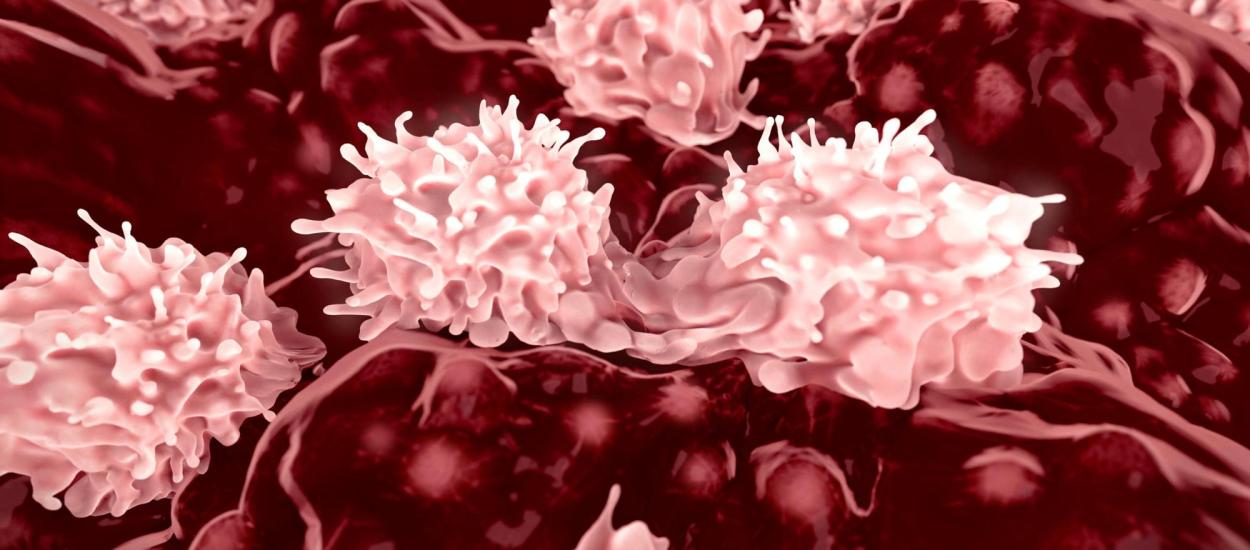 De ce se răspândește cancerul. Cum apar metastazele pulmonare