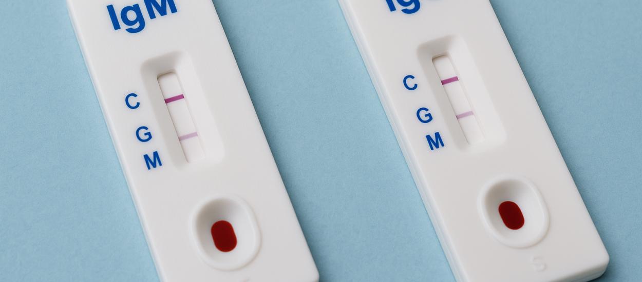 IgM și IgG: care e diferența și ce înseamnă fiecare