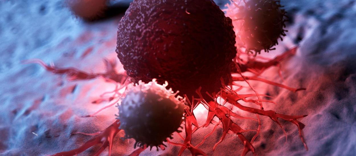 Cancerul care se răspândește în tăcere înainte ca medicii să-l detecteze